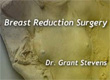 breast reduction Los Angeles